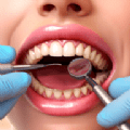 清洁牙齿狂热(Clean Teeth Craze)